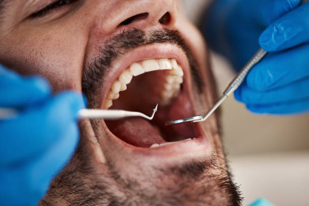 Best Emergency Dentist for Knocked-Out Tooth in Manche North Shore, CA