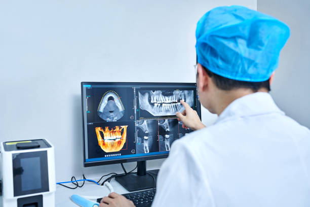Best Emergency Dental Extractions in Manche North Shore, CA